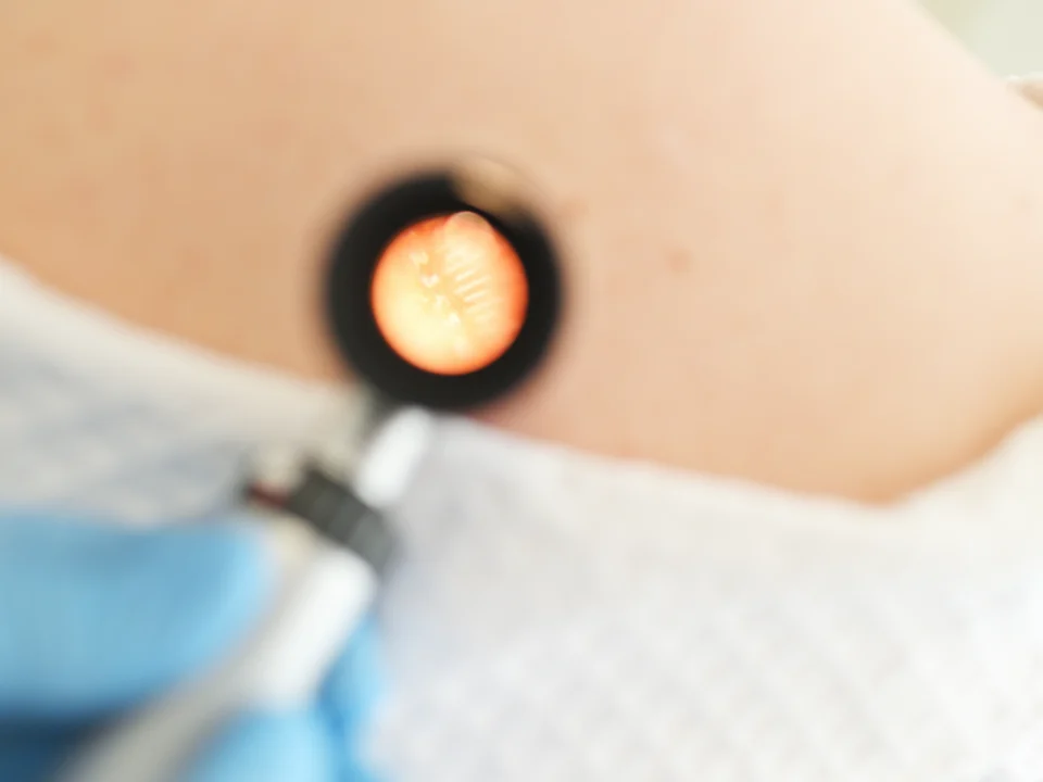 Near complete tattoo removal before and after results