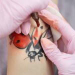 how long does it take to remove a tattoo