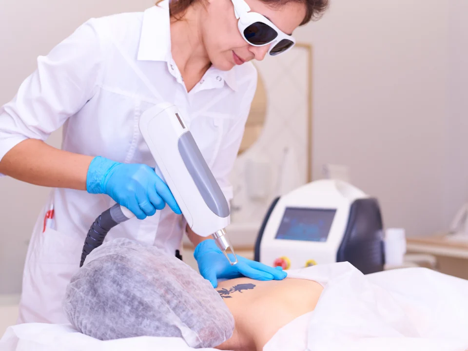 laser tattoo removal cost per session price breakdown
