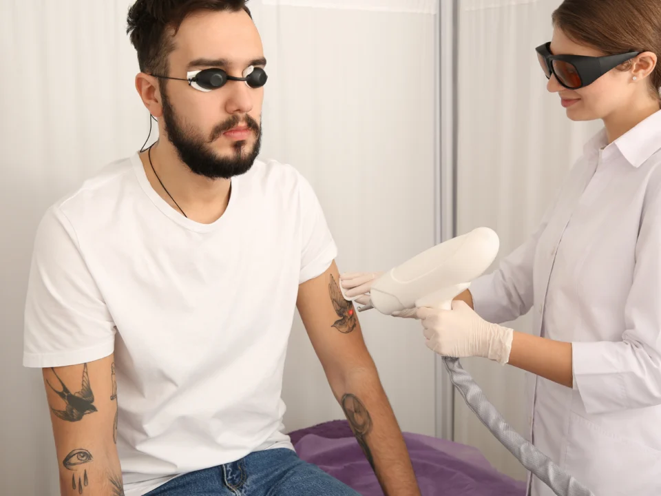 Laser tattoo removal fading process over time comparison