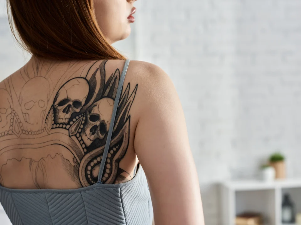 how many sessions for laser tattoo removal timeline cost