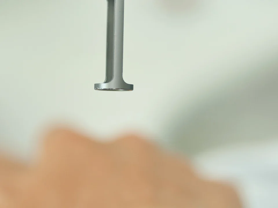 Small tattoo removal before and after laser treatment